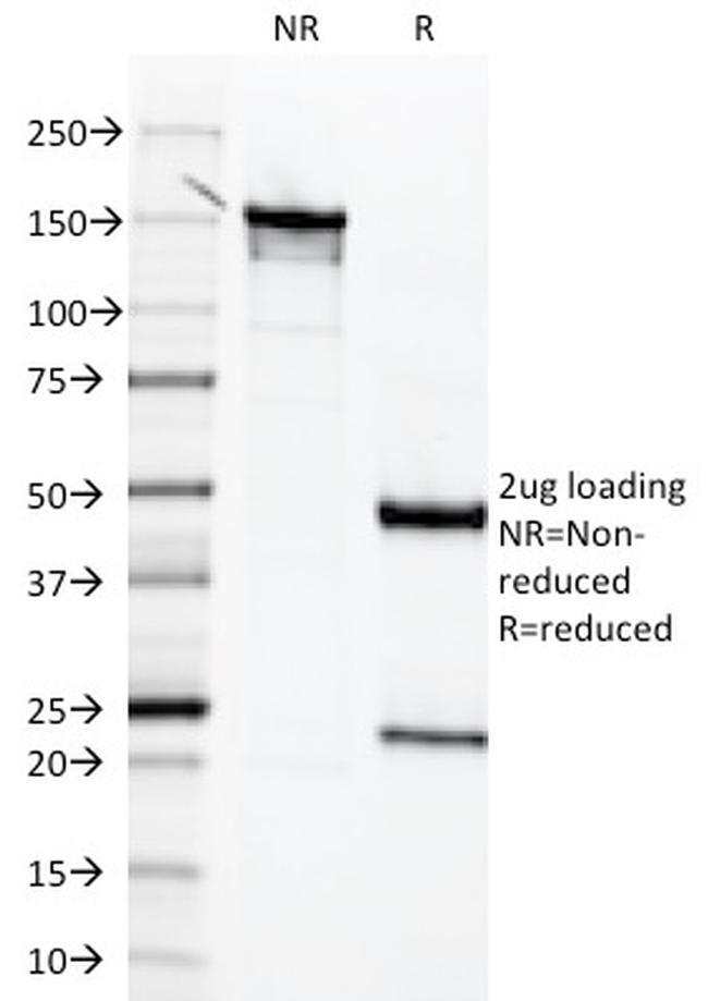 Mesothelin Antibody in SDS-PAGE (SDS-PAGE)