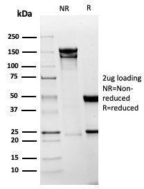 Mesothelin (Mesothelial Marker) Antibody in SDS-PAGE (SDS-PAGE)