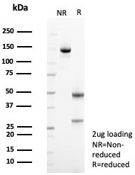 Mesothelin (Mesothelial Marker) Antibody in SDS-PAGE (SDS-PAGE)