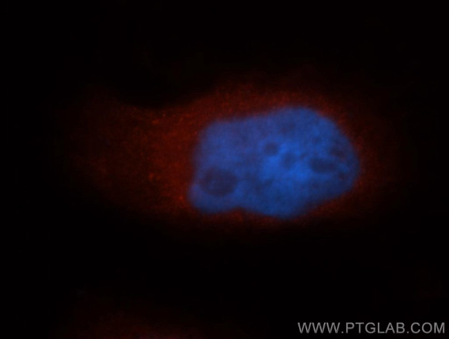 NDE1 Antibody in Immunocytochemistry (ICC/IF)