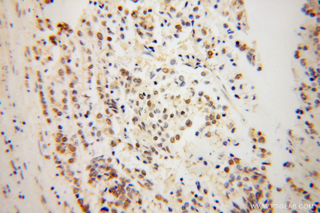 NDE1 Antibody in Immunohistochemistry (Paraffin) (IHC (P))