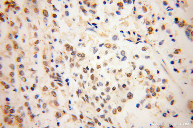 NDE1 Antibody in Immunohistochemistry (Paraffin) (IHC (P))