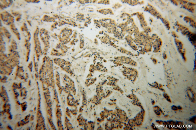 NDE1 Antibody in Immunohistochemistry (Paraffin) (IHC (P))