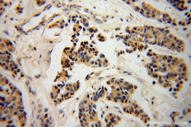 NDE1 Antibody in Immunohistochemistry (Paraffin) (IHC (P))