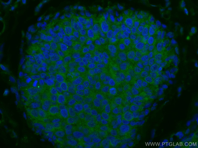 NDE1 Antibody in Immunohistochemistry (PFA fixed) (IHC (PFA))