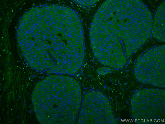 NDE1 Antibody in Immunohistochemistry (PFA fixed) (IHC (PFA))