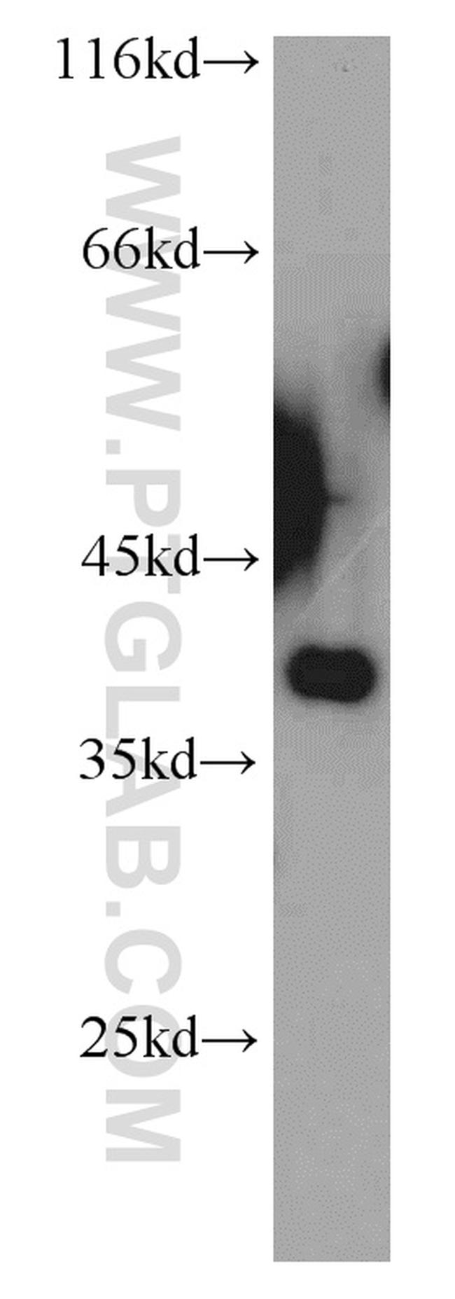 NDE1 Antibody in Western Blot (WB)