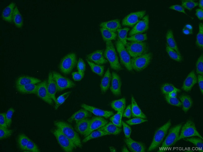 Transgelin 2 Antibody in Immunocytochemistry (ICC/IF)