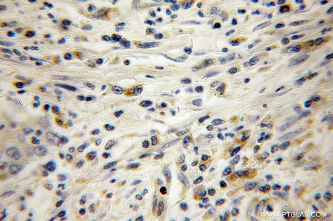 Transgelin 2 Antibody in Immunohistochemistry (Paraffin) (IHC (P))