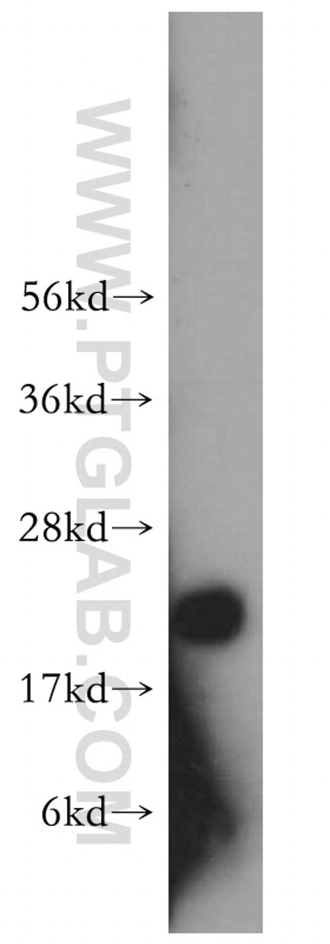 Transgelin 2 Antibody in Western Blot (WB)