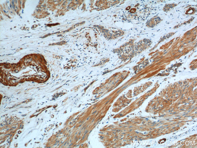 Transgelin 2 Antibody in Immunohistochemistry (Paraffin) (IHC (P))