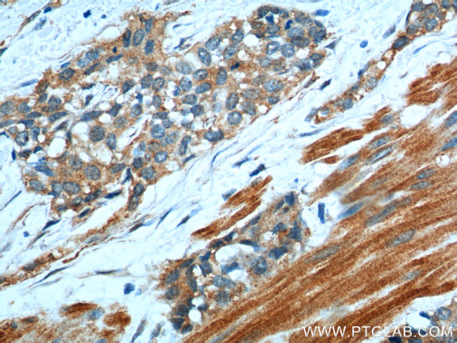 Transgelin 2 Antibody in Immunohistochemistry (Paraffin) (IHC (P))