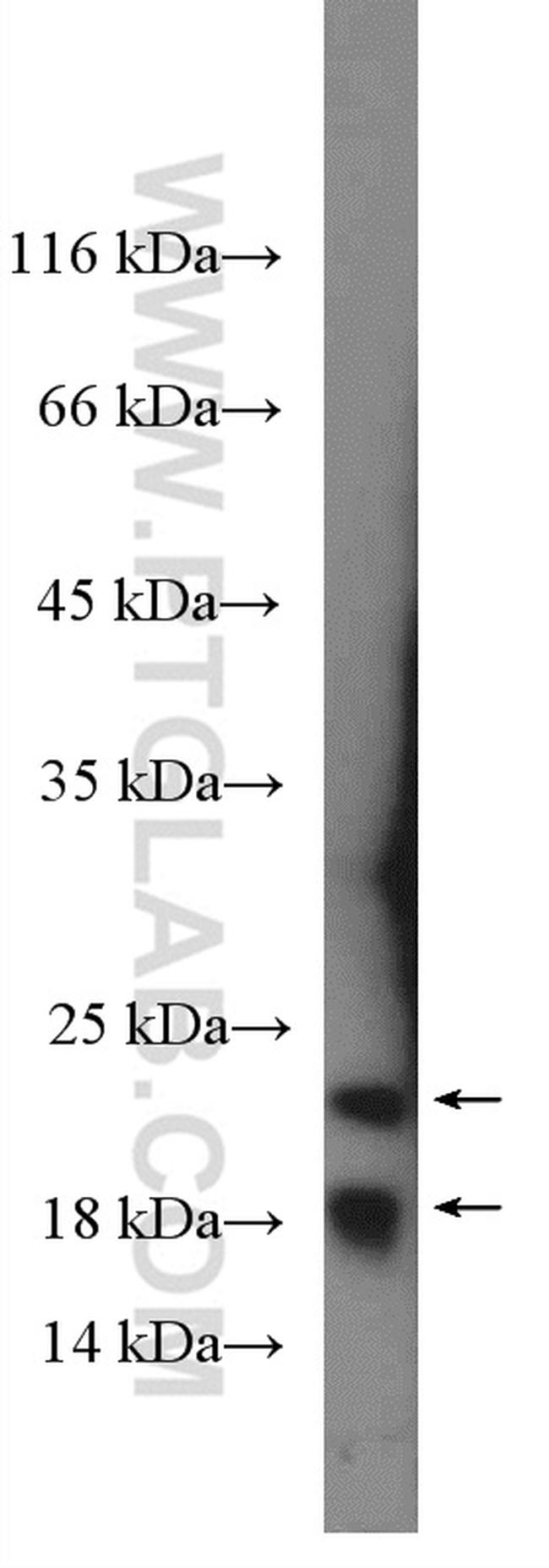 Transgelin 2 Antibody in Western Blot (WB)