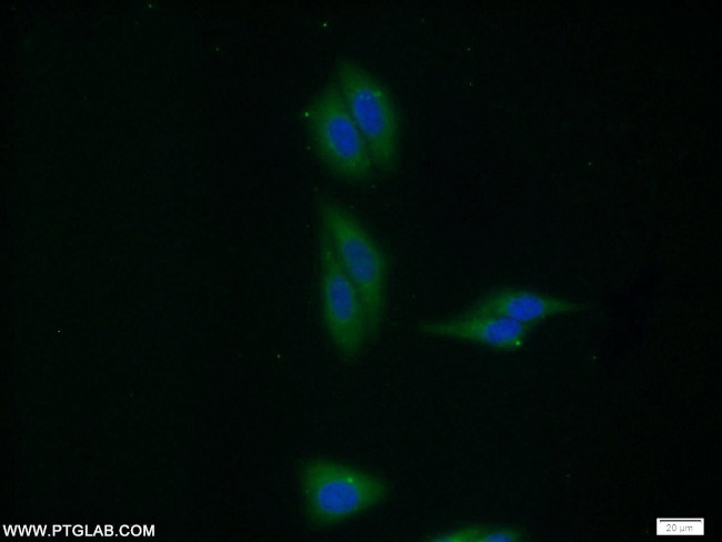 VPS35 Antibody in Immunocytochemistry (ICC/IF)