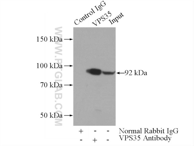 VPS35 Antibody in Immunoprecipitation (IP)