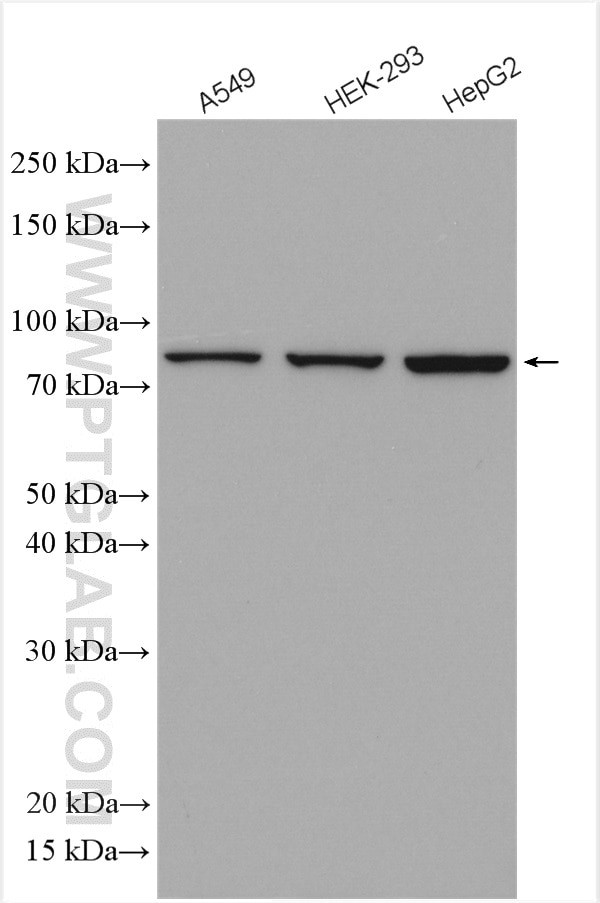 VPS35 Antibody in Western Blot (WB)