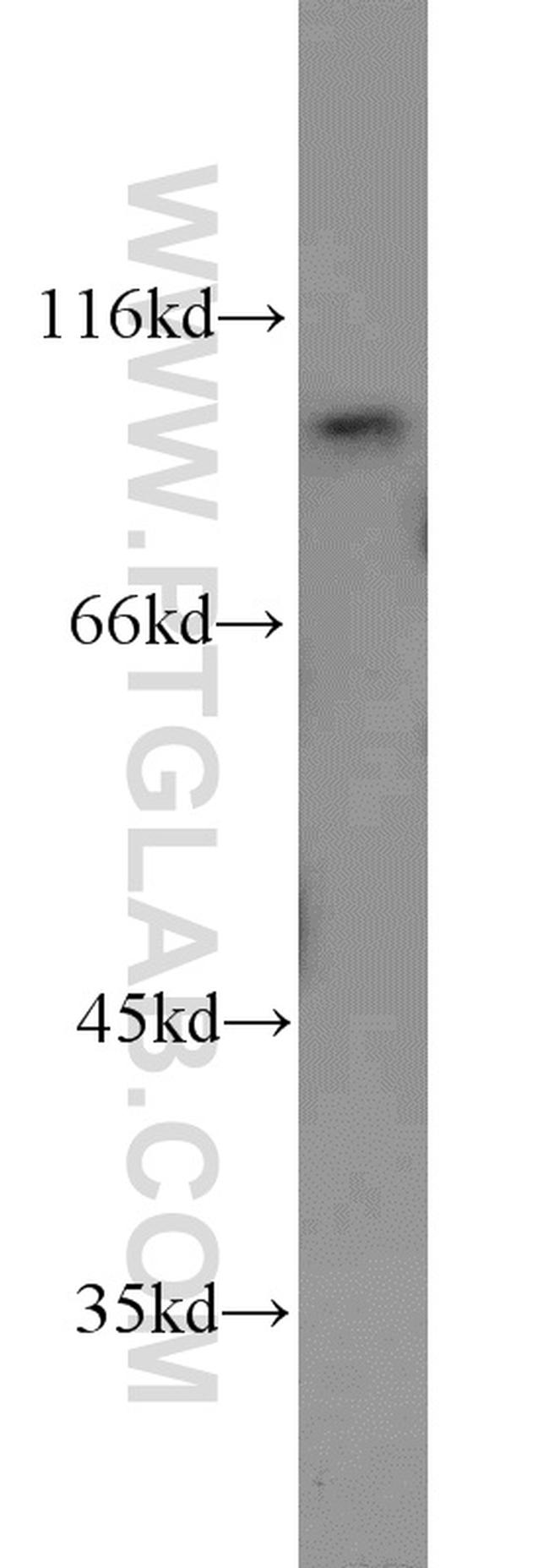 VPS35 Antibody in Western Blot (WB)