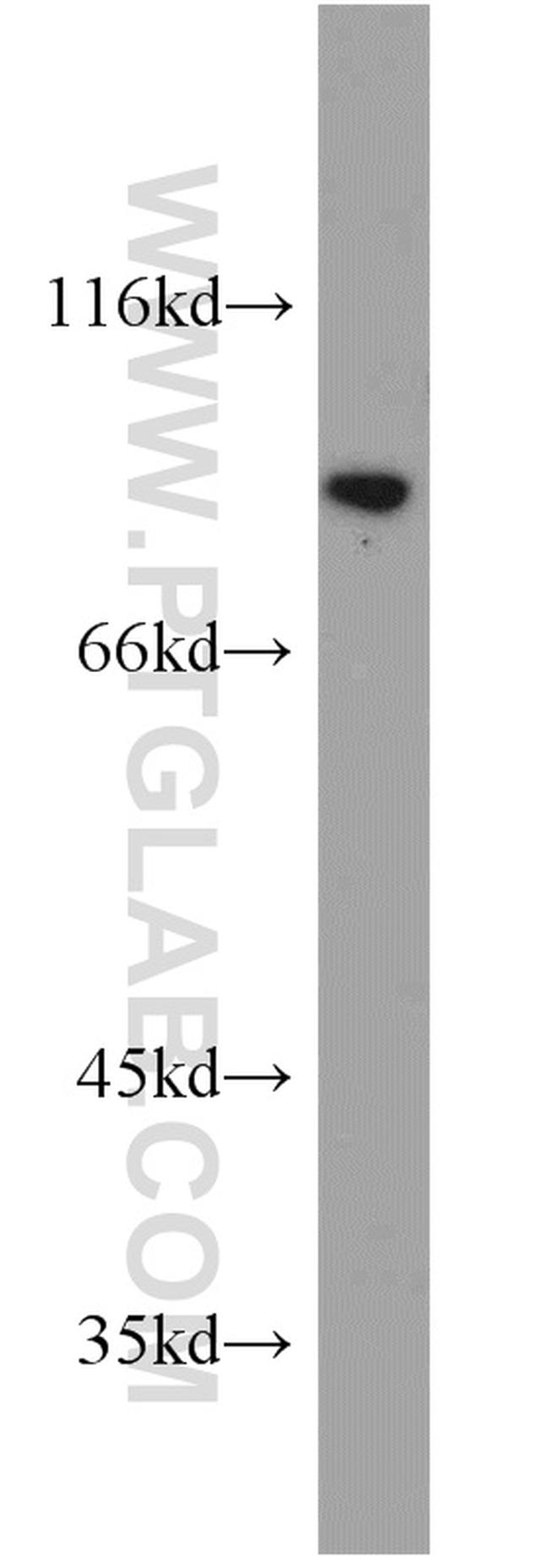 VPS35 Antibody in Western Blot (WB)