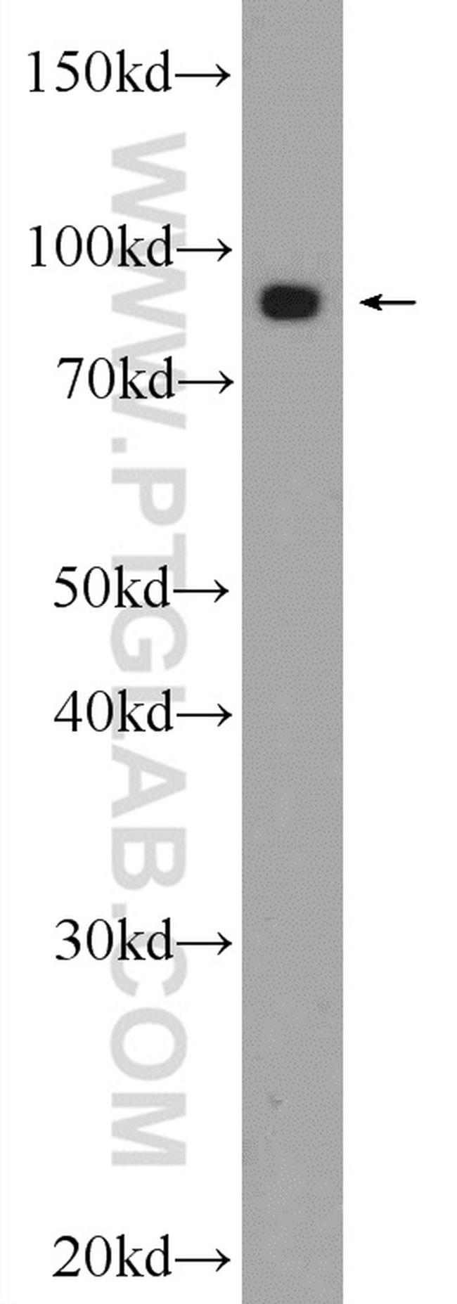 VPS35 Antibody in Western Blot (WB)