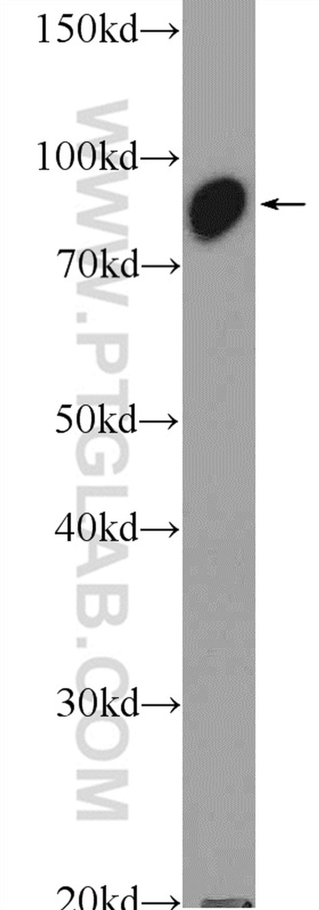 VPS35 Antibody in Western Blot (WB)