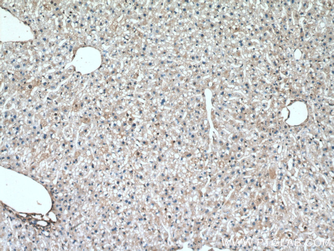 S100A11 Antibody in Immunohistochemistry (Paraffin) (IHC (P))