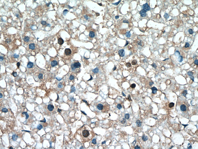 S100A11 Antibody in Immunohistochemistry (Paraffin) (IHC (P))