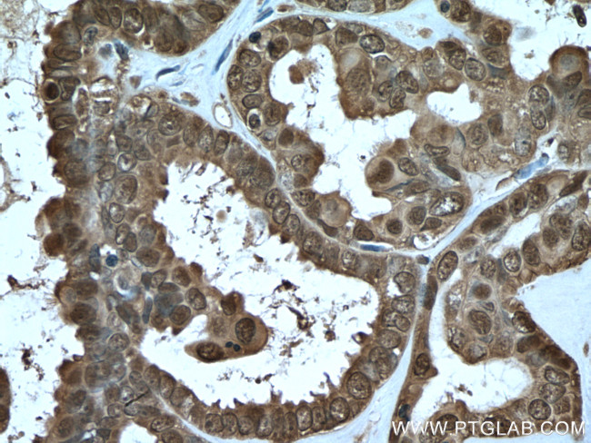 S100A11 Antibody in Immunohistochemistry (Paraffin) (IHC (P))