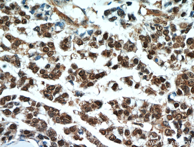 S100A11 Antibody in Immunohistochemistry (Paraffin) (IHC (P))