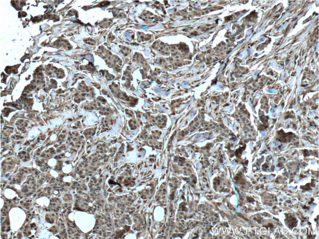 S100A11 Antibody in Immunohistochemistry (Paraffin) (IHC (P))