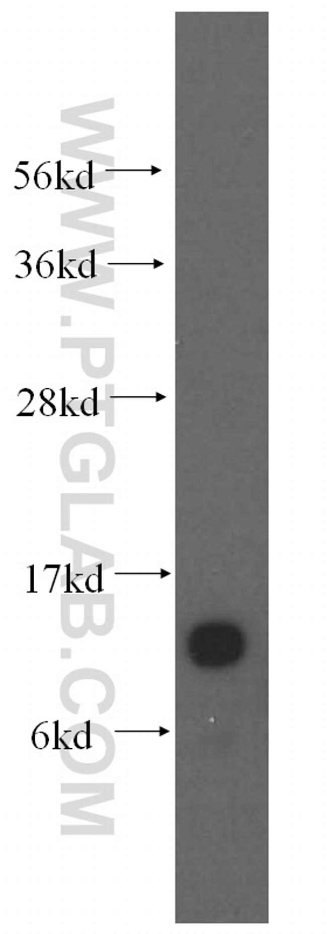 S100A11 Antibody in Western Blot (WB)