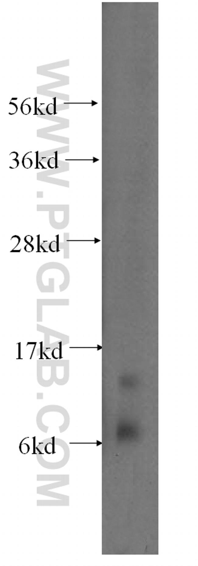 S100A11 Antibody in Western Blot (WB)