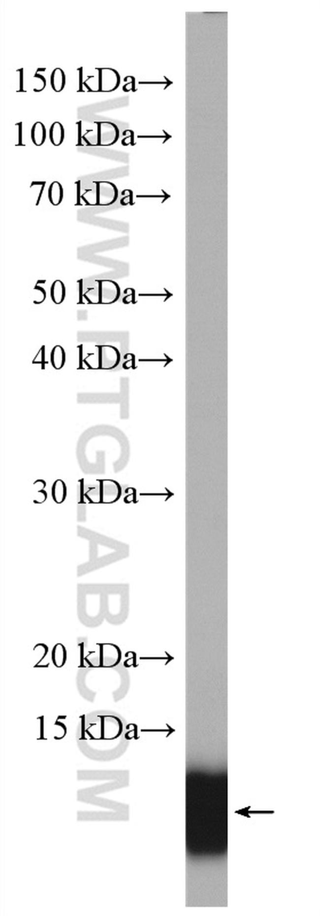 S100A11 Antibody in Western Blot (WB)