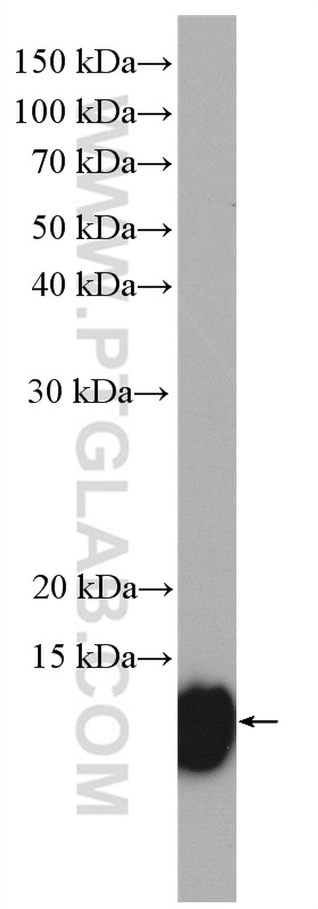 S100A11 Antibody in Western Blot (WB)