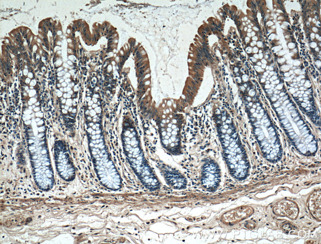 PLEKHA1 Antibody in Immunohistochemistry (Paraffin) (IHC (P))