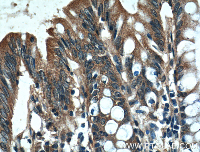 PLEKHA1 Antibody in Immunohistochemistry (Paraffin) (IHC (P))