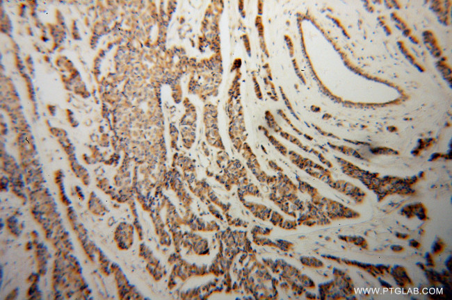 CYC1 Antibody in Immunohistochemistry (Paraffin) (IHC (P))