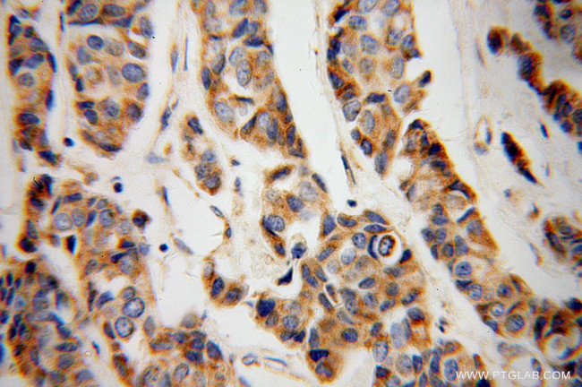 CYC1 Antibody in Immunohistochemistry (Paraffin) (IHC (P))