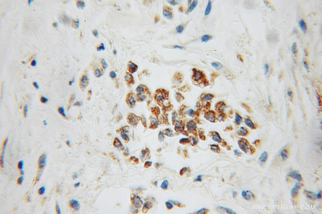 CYC1 Antibody in Immunohistochemistry (Paraffin) (IHC (P))