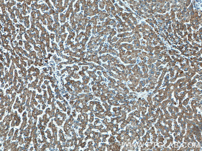 CYC1 Antibody in Immunohistochemistry (Paraffin) (IHC (P))