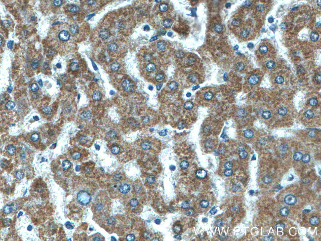 CYC1 Antibody in Immunohistochemistry (Paraffin) (IHC (P))