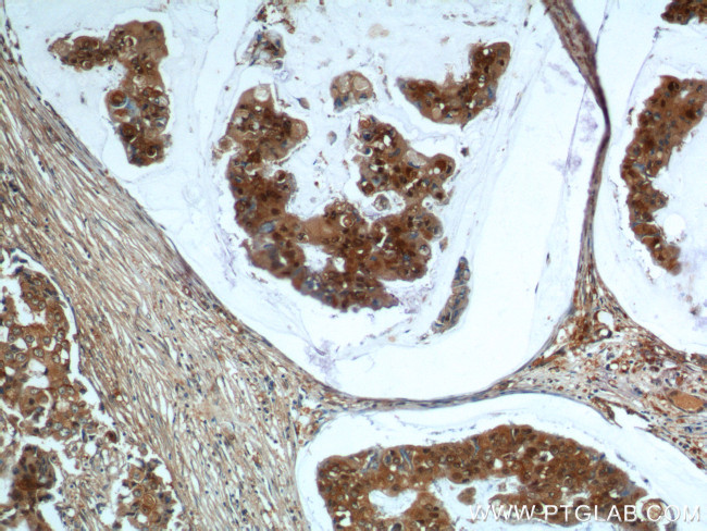 UBC13 Antibody in Immunohistochemistry (Paraffin) (IHC (P))