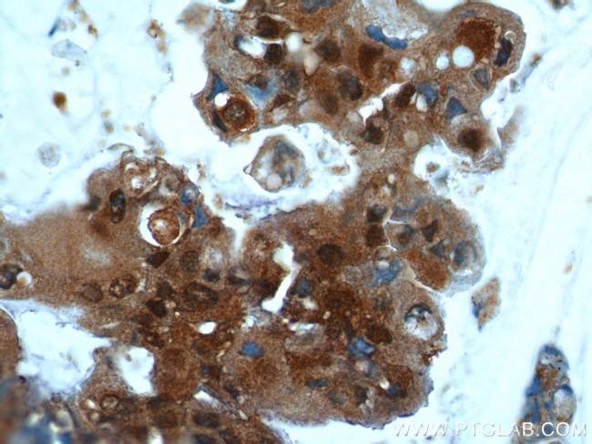 UBC13 Antibody in Immunohistochemistry (Paraffin) (IHC (P))