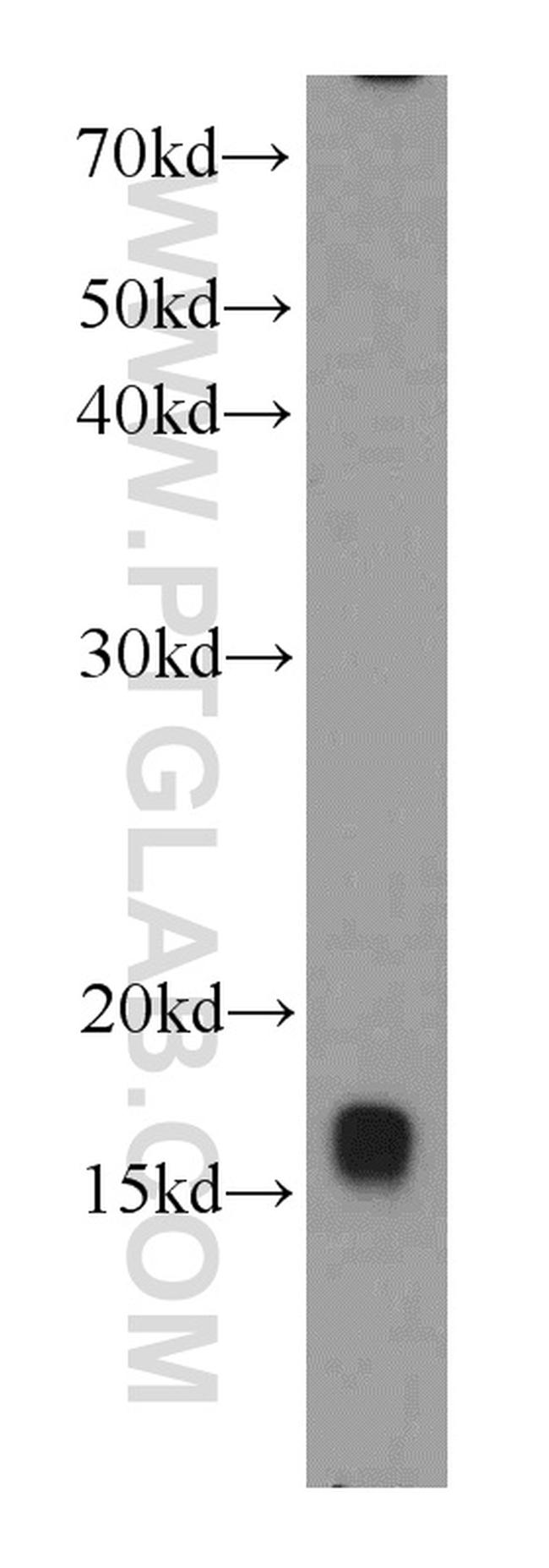 UBC13 Antibody in Western Blot (WB)