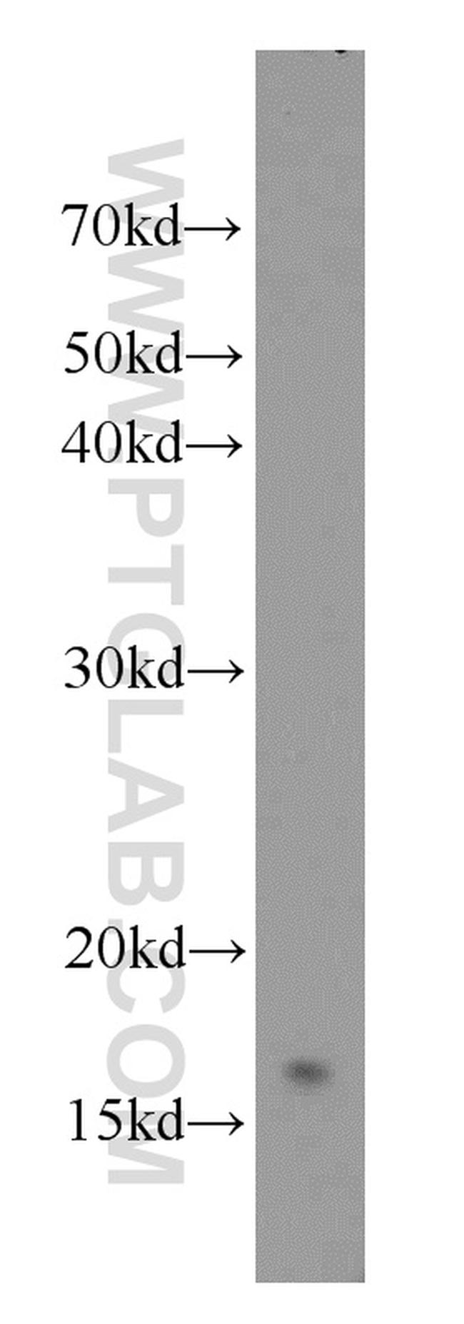 UBC13 Antibody in Western Blot (WB)