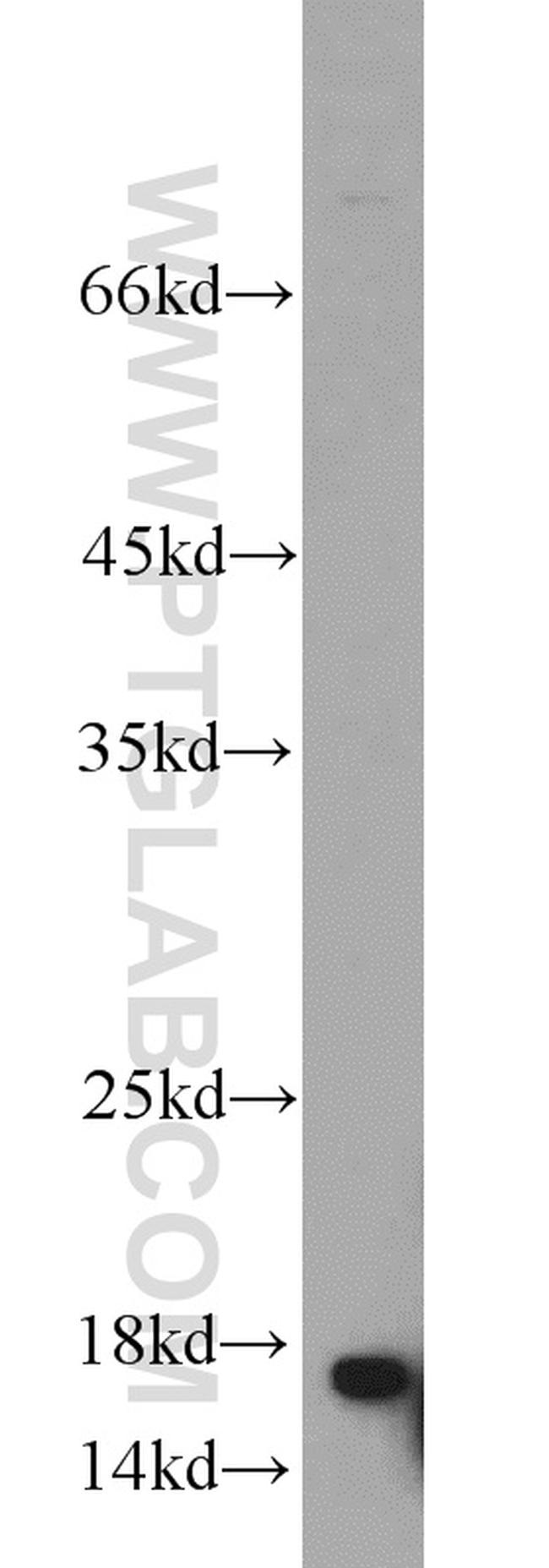 UBC13 Antibody in Western Blot (WB)