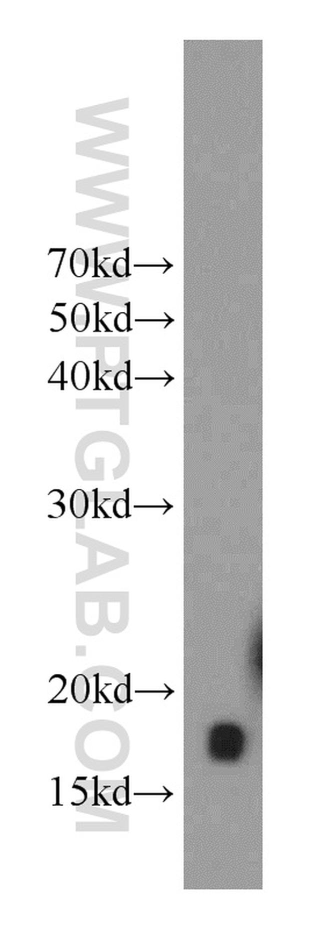 UBC13 Antibody in Western Blot (WB)