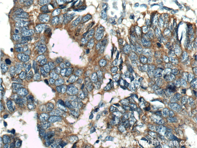 USP11 Antibody in Immunohistochemistry (Paraffin) (IHC (P))