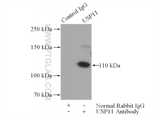 USP11 Antibody in Immunoprecipitation (IP)