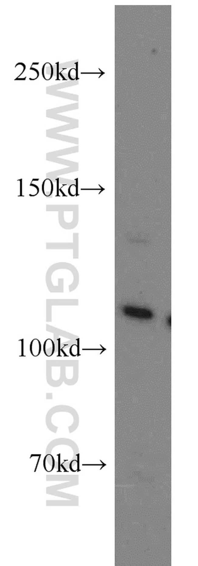 USP11 Antibody in Western Blot (WB)