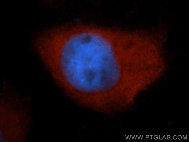 S100A6 Antibody in Immunocytochemistry (ICC/IF)